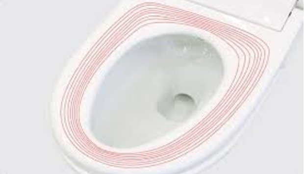 Bồn cầu nắp sưởi ấm sản phẩm bán chạy nhất tháng 12 tại Luxbath
