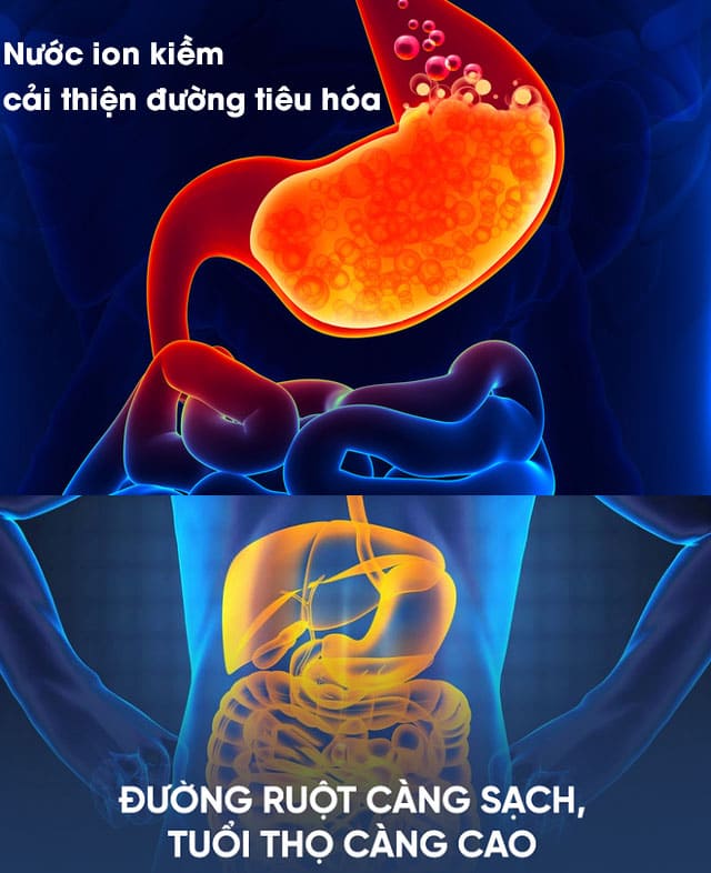 Máy điện giải ion kiềm Impart EXCEL-JX (MX-77) 