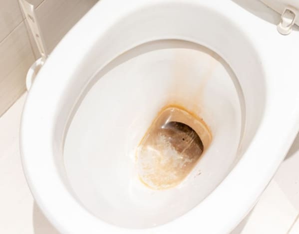 Bồn cầu bị ố vàng