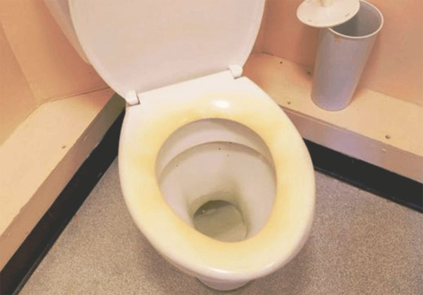 Bồn cầu đã quá cũ, ngả màu hoặc có vết ố cứng đầu